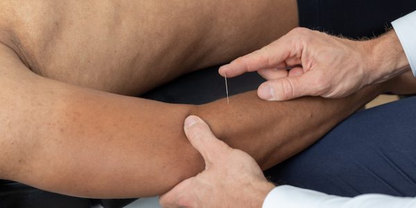 Fysiotherapie en chiropractie Hilversum - Movewell Hilversum #fysio #fysiotherapie #chiropractie #praktijk #Hilversum #movewell #movewellminute #behandeling #rugklachten #sportfysiotherapie #bekkenklachten #nekklachten